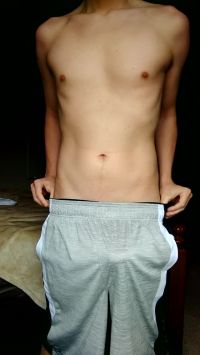 Skinny Tall Guy